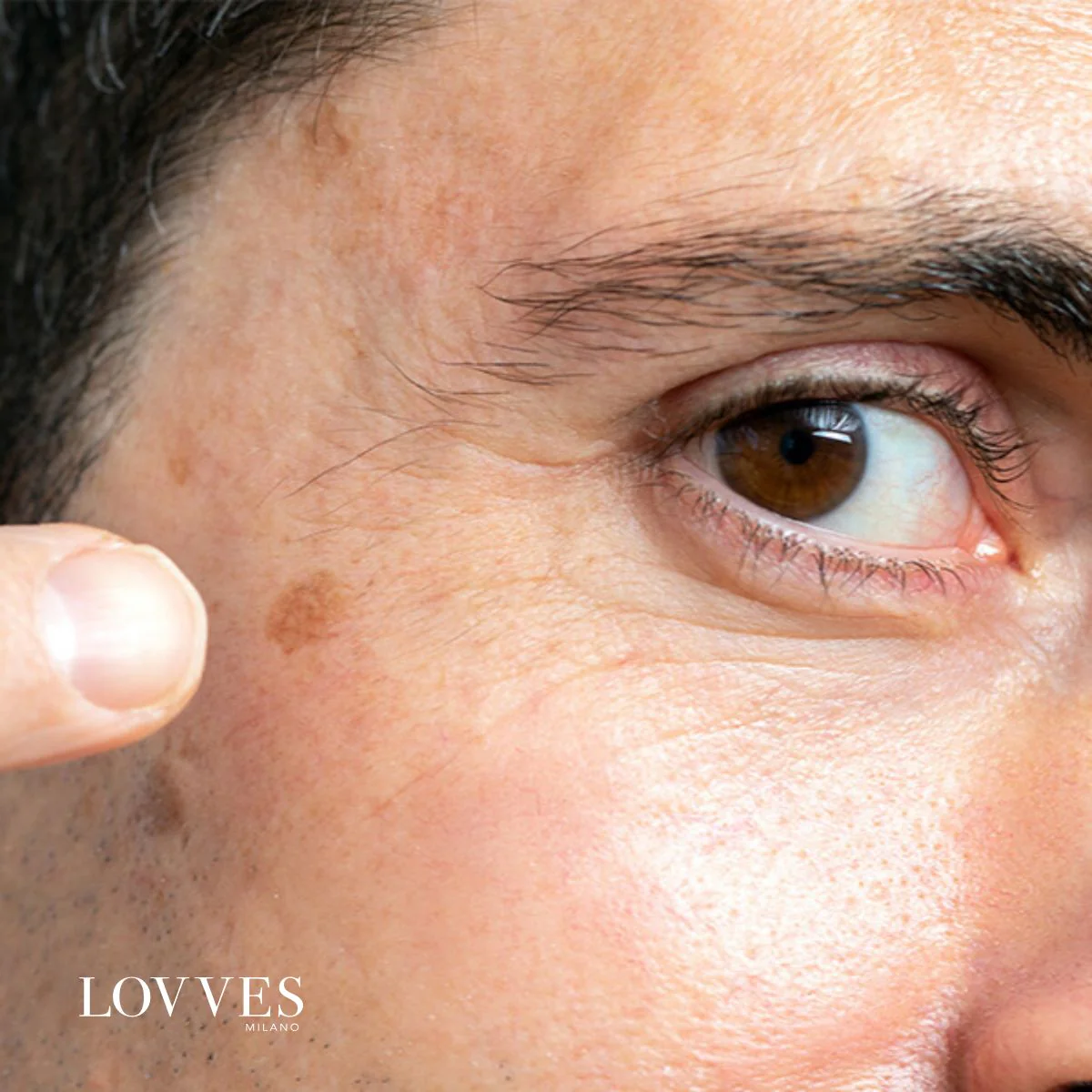 Lovves Sérum Aclarante Manchas Faciales Despigmentante - Image 5
