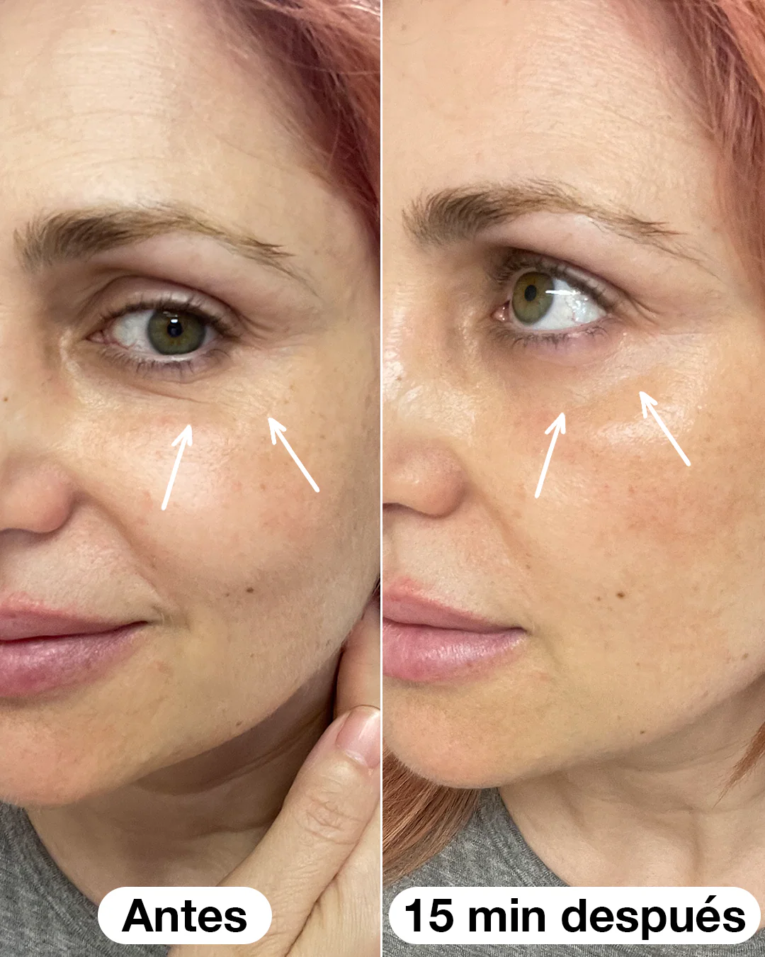 Sérum Roll-on Eye - Image 3